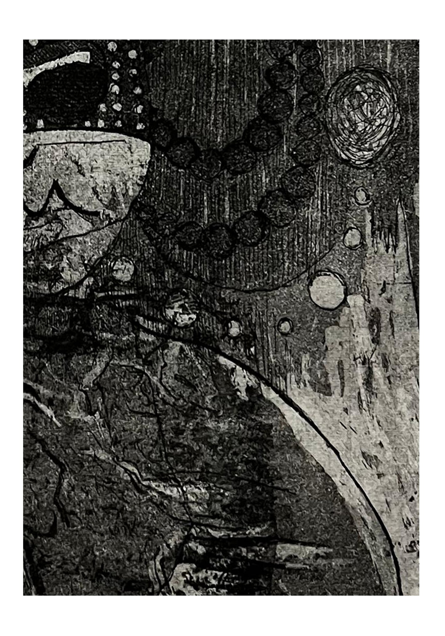 Trauma – II of II